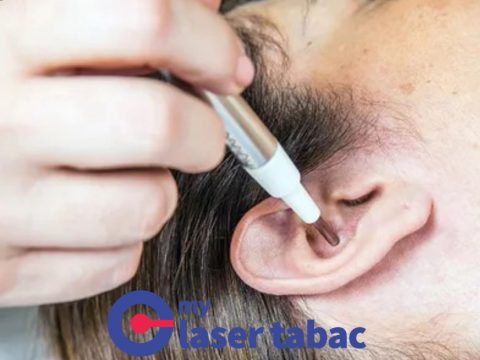 Le laser pour lutter contre les addictions