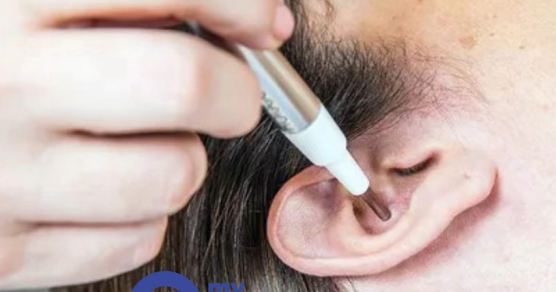 Le laser pour lutter contre les addictions Le laser pour lutter contre les addictions